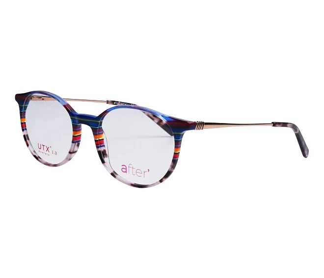 After Brille AF175 01 51 18 blaublau
